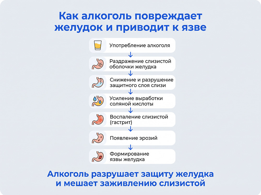 Как алкоголь влияет на желудок и приводит к язве