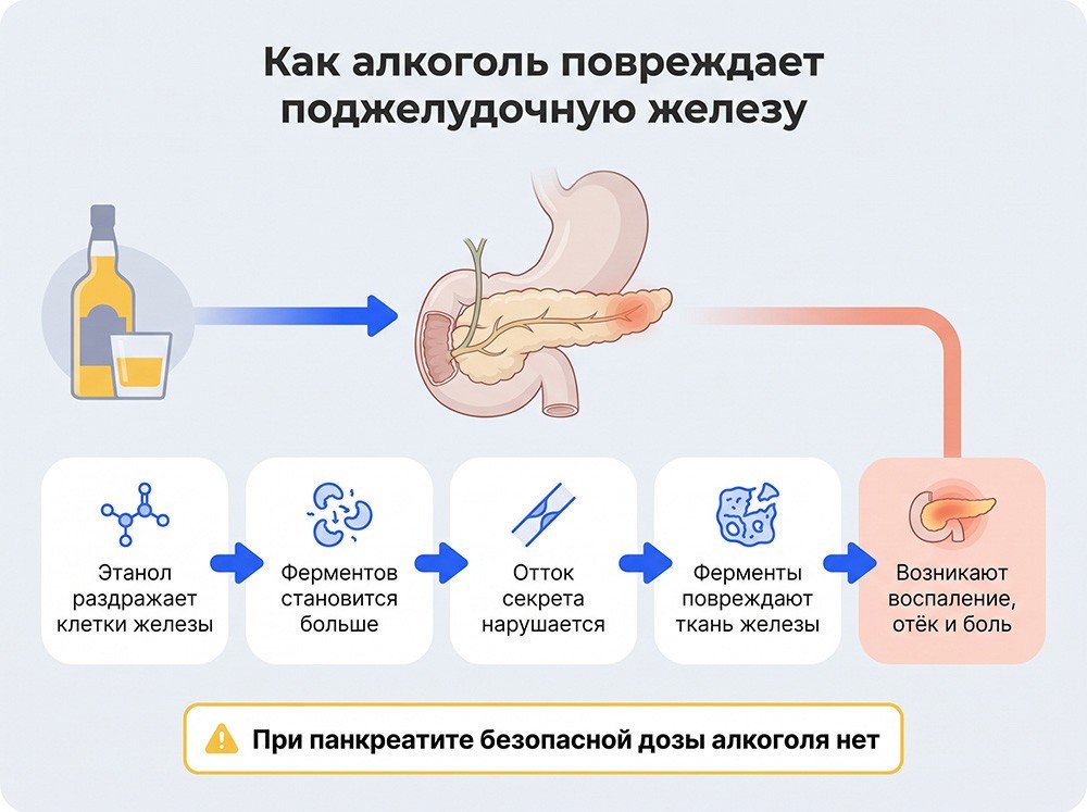 Влияние алкоголя на поджелудочную железу