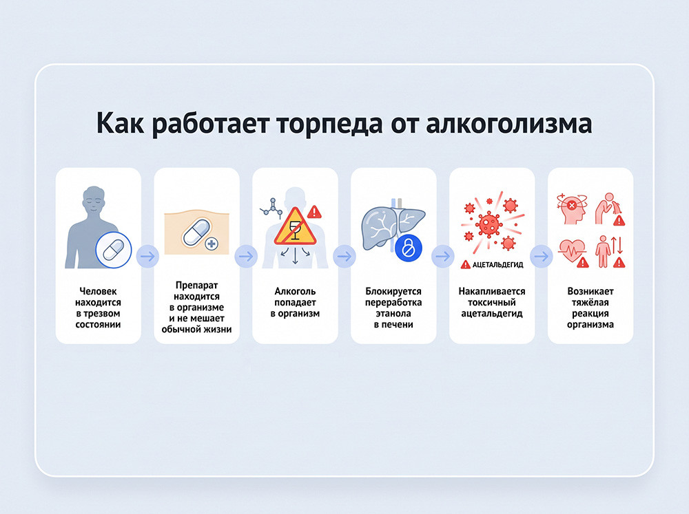 Принцип работы вшивания торпедо
