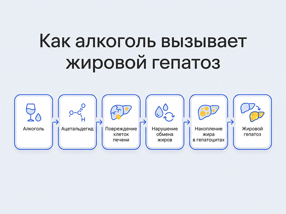 Почему развивается алкогольный гепатоз