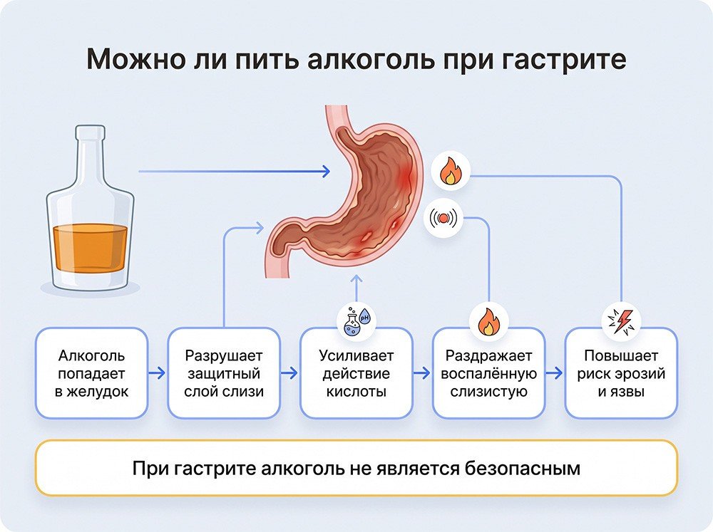 Как алкоголь воздействует на желудок при гастрите