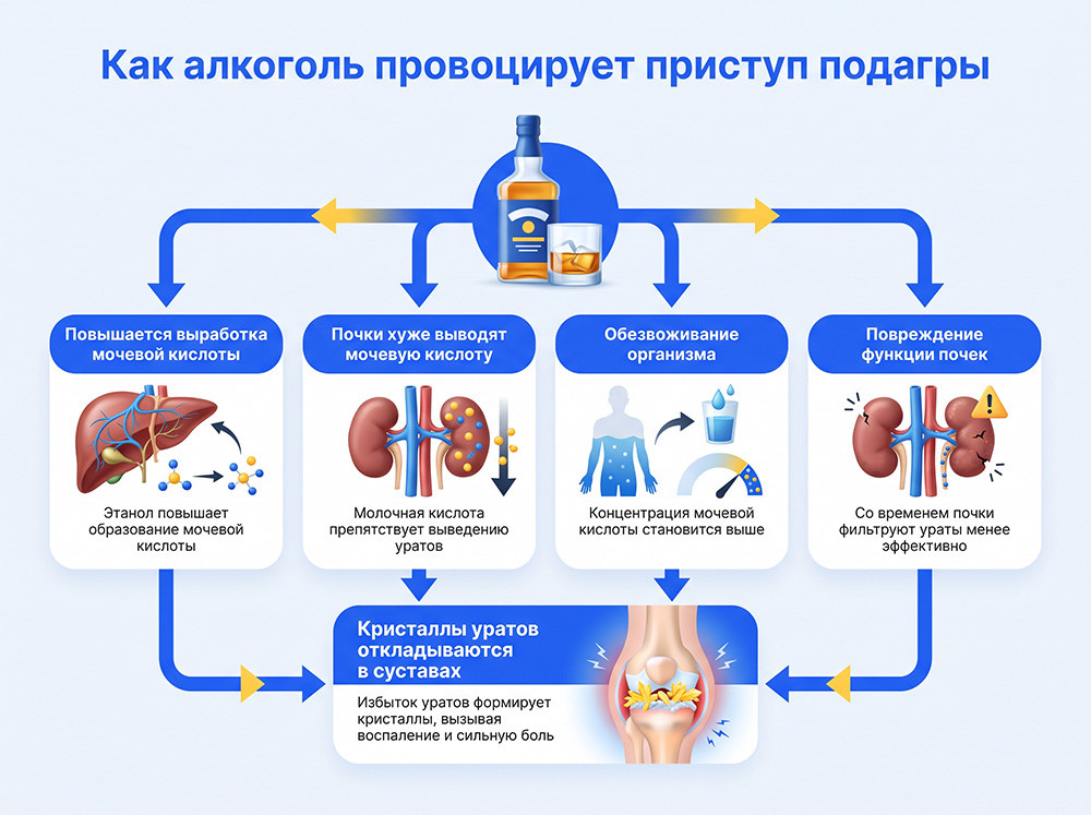 Как алкоголь влияет на подагру